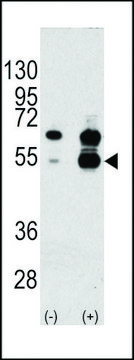 ANTI-VEGF1(N-TERMINAL) antibody produced in rabbit IgG fraction of antiserum, buffered aqueous solution