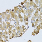 Anti-BNIP3 antibody produced in rabbit