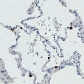Monoclonal Anti-MMP9 antibody produced in mouse Prestige Antibodies&#174; Powered by Atlas Antibodies, clone CL0538, purified immunoglobulin, buffered aqueous glycerol solution