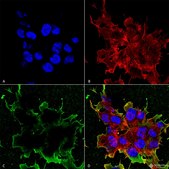 Monoclonal Anti-Tarp Gamma2/4/8 (Stargazin) - Rpe antibody produced in mouse clone S245-36, purified immunoglobulin