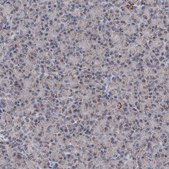 Anti-ALDH5A1 antibody produced in rabbit Prestige Antibodies&#174; Powered by Atlas Antibodies, affinity isolated antibody, buffered aqueous glycerol solution, ab2