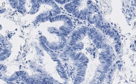 Anti-p-4E-BP1 (Thr37/46) Antibody, clone 1N7 ZooMAb&#174; Rabbit Monoclonal recombinant, expressed in HEK 293 cells