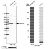 Anti-ATP6V1B2 antibody produced in rabbit Prestige Antibodies&#174; Powered by Atlas Antibodies, affinity isolated antibody, buffered aqueous glycerol solution