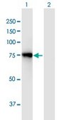 Anti-ACSL3 antibody produced in mouse purified immunoglobulin, buffered aqueous solution