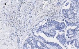 Anti-Acetyl Histone H3 (Lys9 and 14) Antibody, clone 5H20, ZooMAb&#174; Rabbit Monoclonal recombinant, expressed in HEK 293 cells