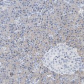 Anti-ADHFE1 antibody produced in rabbit Prestige Antibodies&#174; Powered by Atlas Antibodies, affinity isolated antibody, buffered aqueous glycerol solution