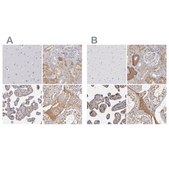 Anti-SERPINA1 antibody produced in rabbit Prestige Antibodies&#174; Powered by Atlas Antibodies, affinity isolated antibody, buffered aqueous glycerol solution
