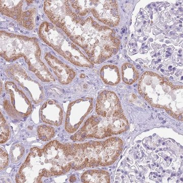 Anti-SYS1 antibody produced in rabbit Prestige Antibodies&#174; Powered by Atlas Antibodies, affinity isolated antibody, buffered aqueous glycerol solution