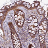 Anti-QARS antibody produced in rabbit Prestige Antibodies&#174; Powered by Atlas Antibodies, affinity isolated antibody, buffered aqueous glycerol solution