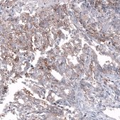 Anti-CD99 antibody produced in mouse Prestige Antibodies&#174; Powered by Atlas Antibodies, clone CL12929, purified by using Protein A, buffered aqueous glycerol solution