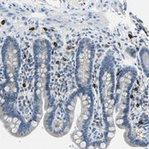Anti-CPA3 antibody produced in rabbit affinity isolated antibody, buffered aqueous glycerol solution