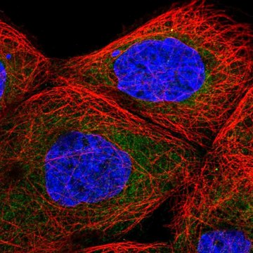 Anti-TBL2 antibody produced in rabbit Prestige Antibodies&#174; Powered by Atlas Antibodies, affinity isolated antibody