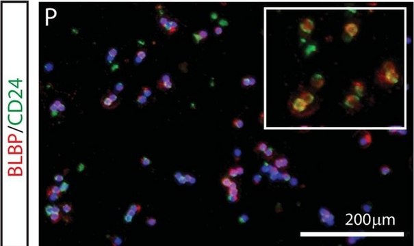 Anti-Brain lipid binding protein Antibody from rabbit, purified by affinity chromatography