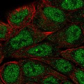 Anti-MUM1 antibody produced in rabbit Prestige Antibodies&#174; Powered by Atlas Antibodies, affinity isolated antibody, buffered aqueous glycerol solution