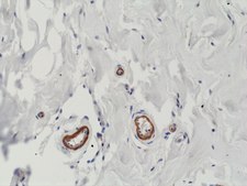 Anti-VEGF (VEGFA) Rabbit Monoclonal Antibody clone RM391, affinity purified immunoglobulin