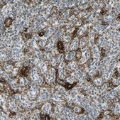 Anti-NGFR antibody produced in rabbit Prestige Antibodies&#174; Powered by Atlas Antibodies, affinity isolated antibody, buffered aqueous glycerol solution