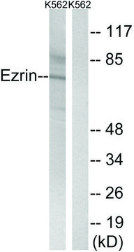Anti-Ezrin antibody produced in rabbit affinity isolated antibody