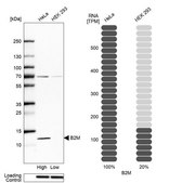 Anti-B2M antibody produced in rabbit Prestige Antibodies&#174; Powered by Atlas Antibodies, affinity isolated antibody, buffered aqueous glycerol solution
