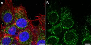Anti-C1QBP Antibody, clone 3D2 ZooMAb&#174; Rabbit Monoclonal recombinant, expressed in HEK 293 cells