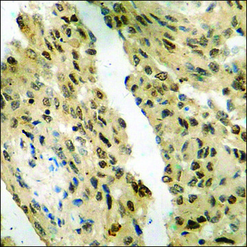 Anti-phospho-FKHR (pSer256) antibody produced in rabbit affinity isolated antibody