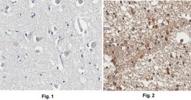 Anti-APP Antibody, CT, clone 2.F2.19B4, Ascites Free clone 2.F2.19B4, from mouse