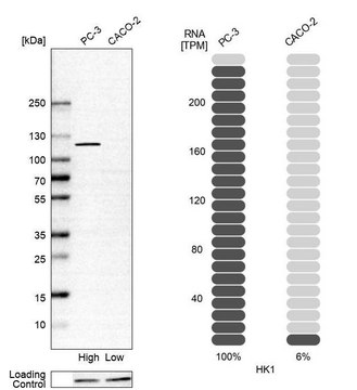 Anti-HK1 antibody produced in rabbit Prestige Antibodies&#174; Powered by Atlas Antibodies, affinity isolated antibody, buffered aqueous glycerol solution