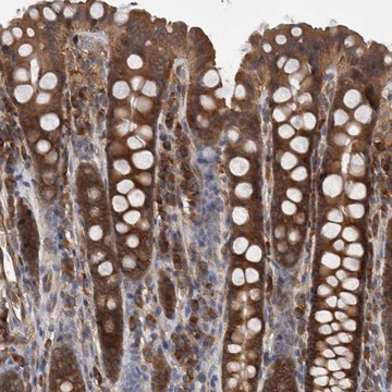 Anti-SMCR8 antibody produced in rabbit Prestige Antibodies&#174; Powered by Atlas Antibodies, affinity isolated antibody, buffered aqueous glycerol solution, Ab2