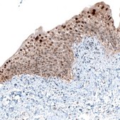 Anti-NR4A3 antibody produced in rabbit Prestige Antibodies&#174; Powered by Atlas Antibodies, affinity isolated antibody, buffered aqueous glycerol solution