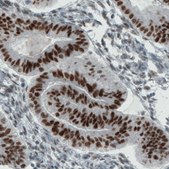 Monoclonal Anti-ESR1 antibody produced in mouse Prestige Antibodies&#174; Powered by Atlas Antibodies, clone CL1196, purified immunoglobulin, buffered aqueous glycerol solution
