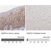 Anti-CKAP4 antibody produced in rabbit Ab2, Prestige Antibodies&#174; Powered by Atlas Antibodies, affinity isolated antibody, buffered aqueous glycerol solution