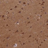 Anti-BICD1 antibody produced in rabbit Prestige Antibodies&#174; Powered by Atlas Antibodies, affinity isolated antibody, buffered aqueous glycerol solution