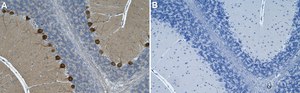 Anti-p-PKC&#947; (Thr514) Antibody, clone 4F20 ZooMAb&#174; Rabbit Monoclonal recombinant, expressed in HEK 293 cells