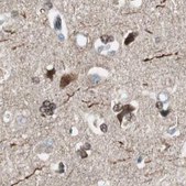 Anti-ZHX2 antibody produced in rabbit Prestige Antibodies&#174; Powered by Atlas Antibodies, affinity isolated antibody, buffered aqueous glycerol solution