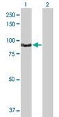Anti-TNNI3K antibody produced in rabbit purified immunoglobulin, buffered aqueous solution