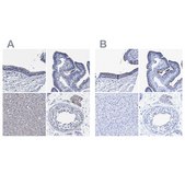 Anti-CROCC antibody produced in rabbit Prestige Antibodies&#174; Powered by Atlas Antibodies, affinity isolated antibody, buffered aqueous glycerol solution, Ab2