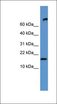 Anti-FGF1 antibody produced in rabbit affinity isolated antibody