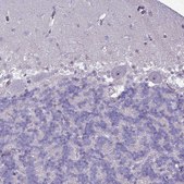 Anti-SLC15A3 antibody produced in rabbit Prestige Antibodies&#174; Powered by Atlas Antibodies, affinity isolated antibody, buffered aqueous glycerol solution