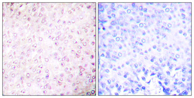 Anti-p300 antibody produced in rabbit affinity isolated antibody