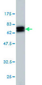 Monoclonal Anti-NDRG1 antibody produced in mouse clone 2D7, purified immunoglobulin, buffered aqueous solution