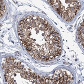 Anti-NECTIN2 antibody produced in rabbit Prestige Antibodies&#174; Powered by Atlas Antibodies, affinity isolated antibody, buffered aqueous glycerol solution