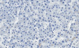 Anti-Aquaporin-9 Antibody, clone 1E4 ZooMAb&#174; Rabbit Monoclonal recombinant, expressed in HEK 293 cells