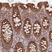 Anti-MRPS16 antibody produced in rabbit Prestige Antibodies&#174; Powered by Atlas Antibodies, affinity isolated antibody, buffered aqueous glycerol solution