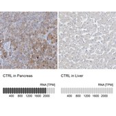 Anti-CTRL antibody produced in rabbit Prestige Antibodies&#174; Powered by Atlas Antibodies, affinity isolated antibody, buffered aqueous glycerol solution