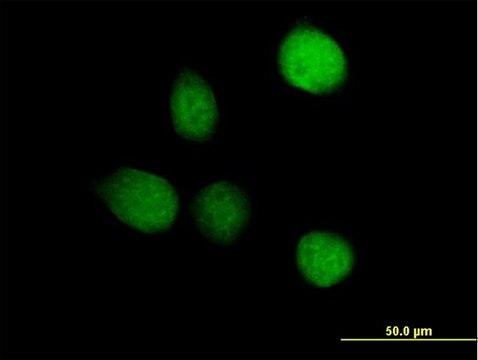 Anti-TSEN2 antibody produced in mouse IgG fraction of antiserum, buffered aqueous solution