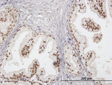 Anti-RAD23B antibody produced in mouse IgG fraction of antiserum, buffered aqueous solution