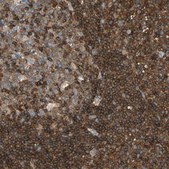 Anti-FMNL1 antibody produced in rabbit Prestige Antibodies&#174; Powered by Atlas Antibodies, affinity isolated antibody, buffered aqueous glycerol solution