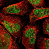 Anti-PHC1 antibody produced in rabbit Prestige Antibodies&#174; Powered by Atlas Antibodies, affinity isolated antibody, buffered aqueous glycerol solution