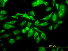 Monoclonal Anti-KIFC1 antibody produced in mouse clone 2B9, purified immunoglobulin, buffered aqueous solution