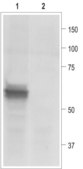 Anti-Purinergic Receptor P2X3 antibody produced in rabbit affinity isolated antibody, lyophilized powder