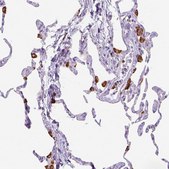 Anti-CD68 antibody produced in rabbit Prestige Antibodies&#174; Powered by Atlas Antibodies, affinity isolated antibody, buffered aqueous glycerol solution